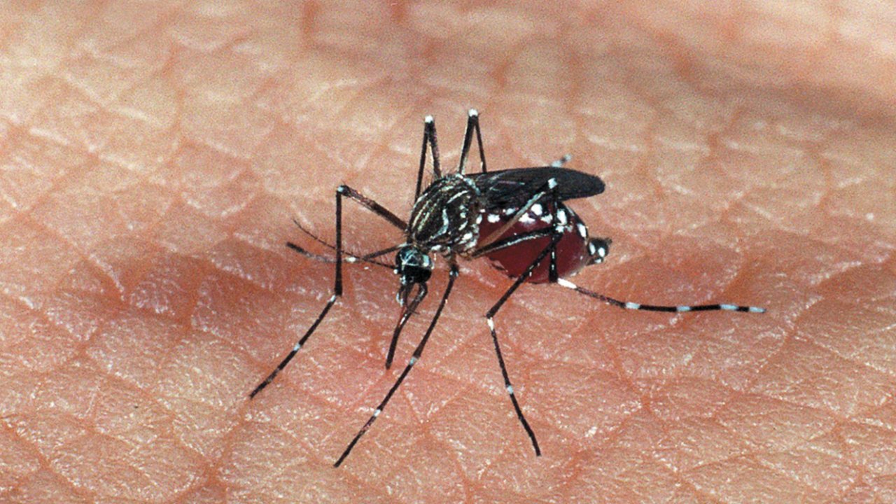 zika causa microcefalia?