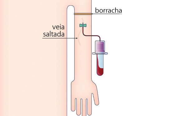 1. A Coleta