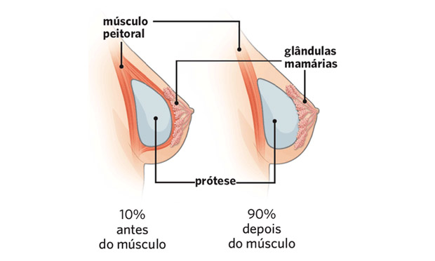 1. Procedimento