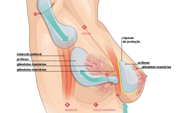 5. A reação do corpo