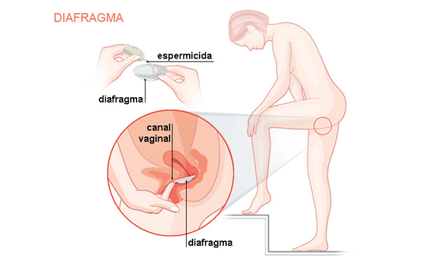 Diafragma Diafragma