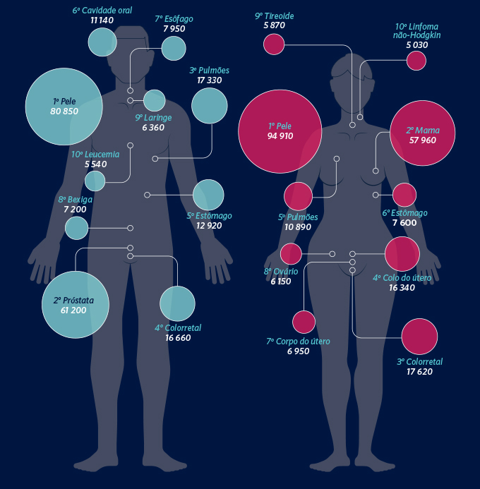 Ranking do câncer em homens e mulheres Câncer