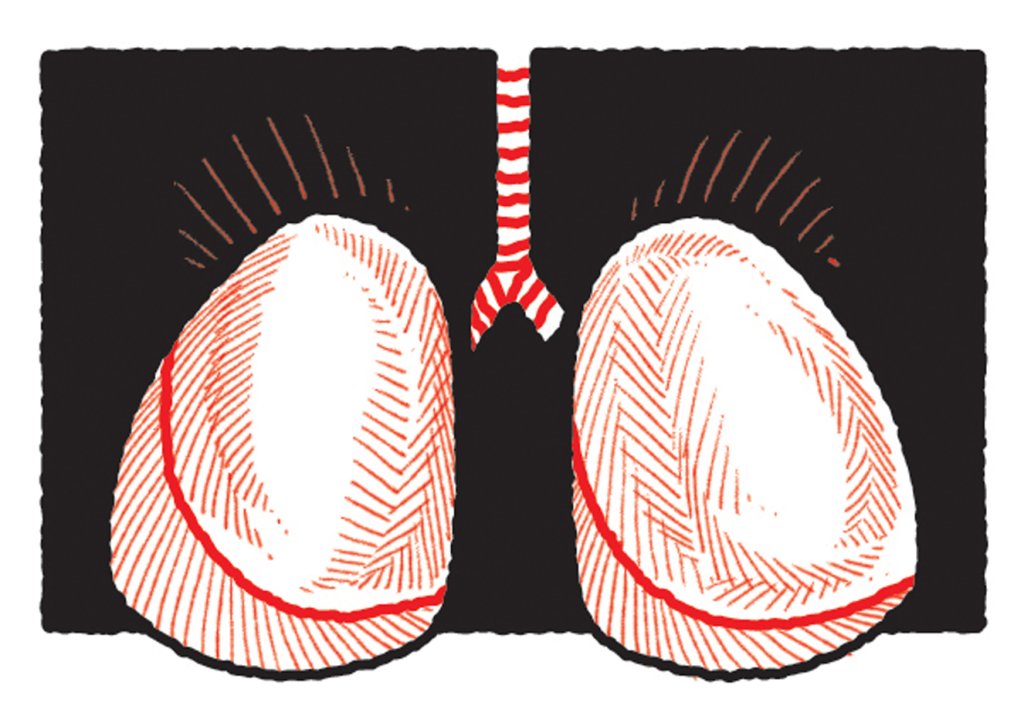 hipertensão-pulmonar