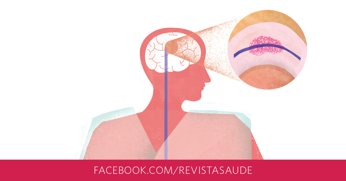 problema vascular na cabeça