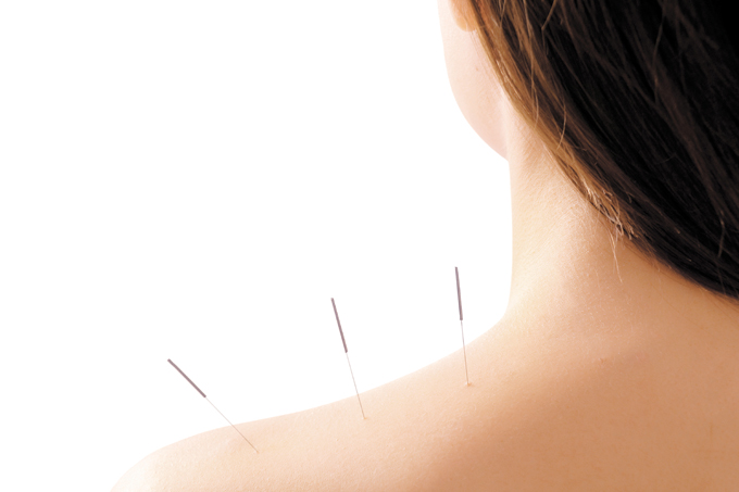 Sofre com a asma? Acupuntura nela!