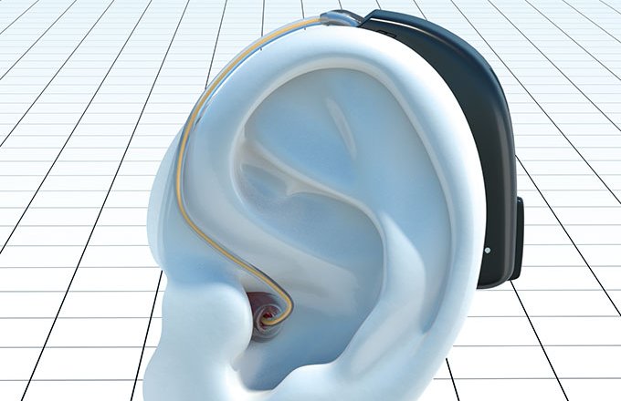 Aparelhos auditivos com bluetooth mudam a vida dos usuários - Ricardo  Shimosakai