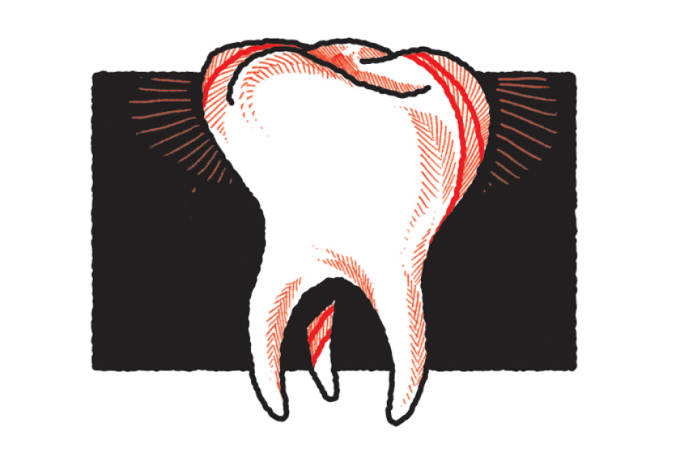 Homem Mandíbula Ou Maxilar Osso Com Dentes Em Três Quartos De