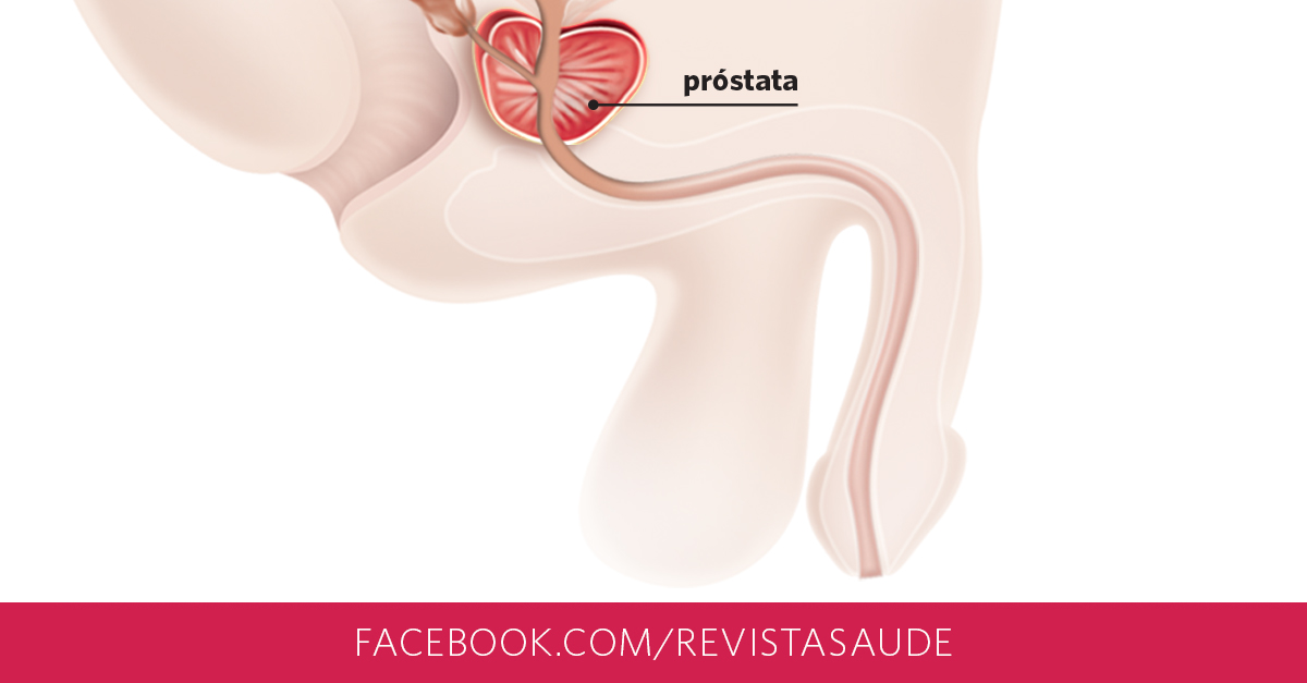 cancer de prostata pode matar