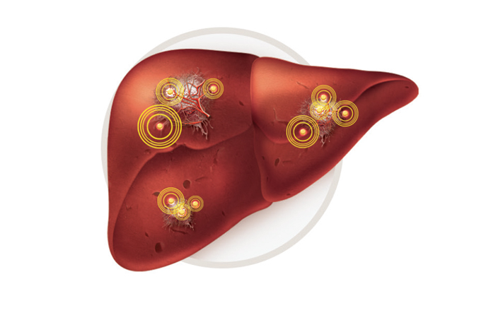 pcdt hepatite c no fígado