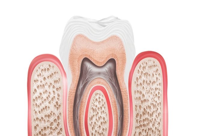 Canal no dente: há outro tratamento contra cárie