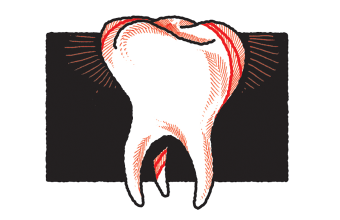 Dor em vários dentes ao mesmo tempo – qual pode ser a causa