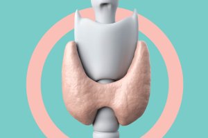 Cisto ou nódulo na tireoide é grave? Mitos e verdades