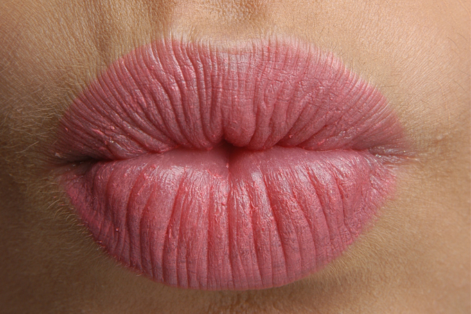 sintomas de câncer de pele nos lábios como evitar