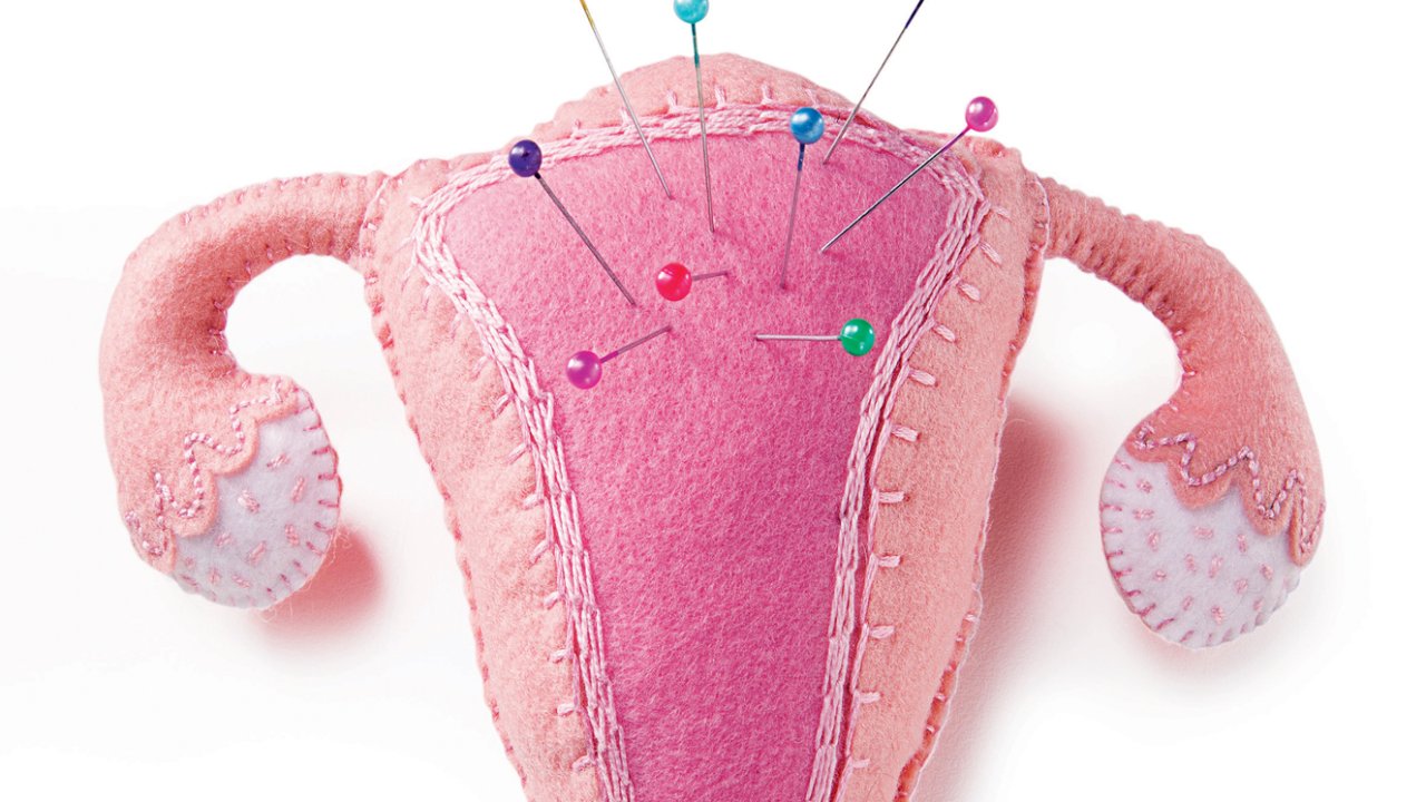 mês da endometriose sintomas engravidar
