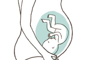 Periodontite está relacionada a parto prematuro