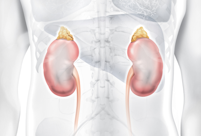 gota causa doença renal cronica