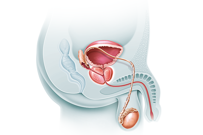 Chaga és prostatitis Prosztata kezelési rendszer