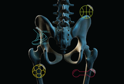 exercício para osteoporose