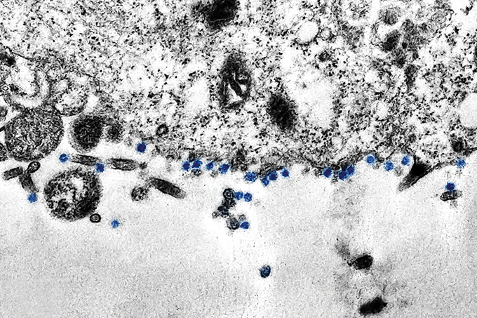 imagem microscópica coronavírus
