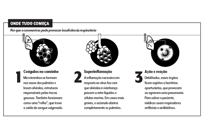 coronavírus pulmões