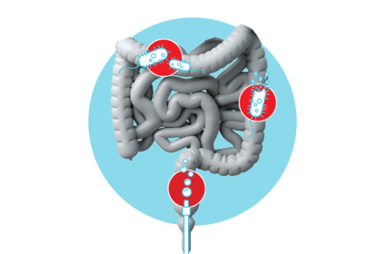 infecção no intestino