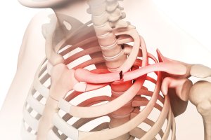 Osteoporose: tratamento e sintomas