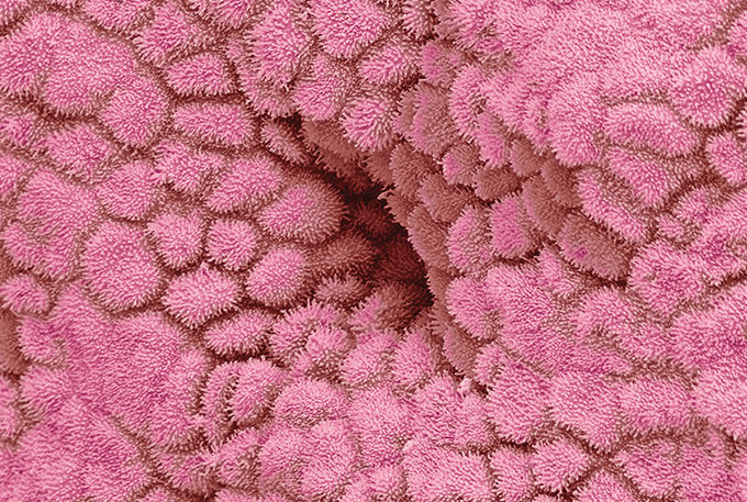 Revestimento do útero em foto tirada com microscópico especial.