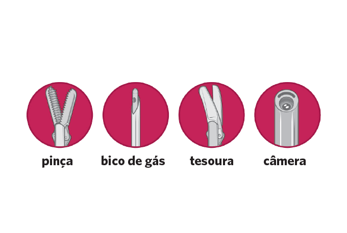 videolaparascopia 3 ferramentas para cirurgia