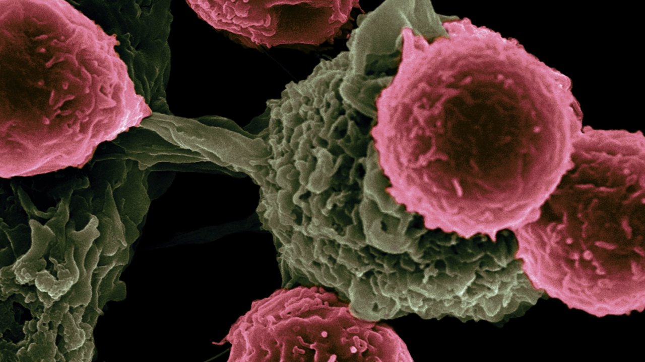 Células de câncer sendo atacadas por coronavírus