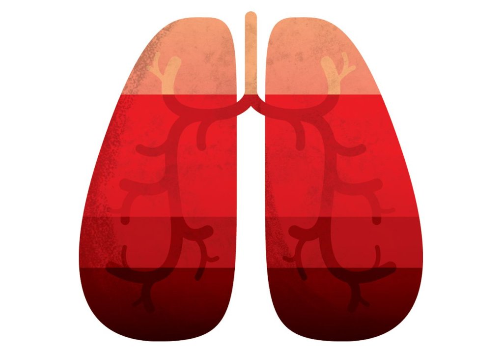 Desenho de pulmão, onde melatonina agiria contra coronavírus