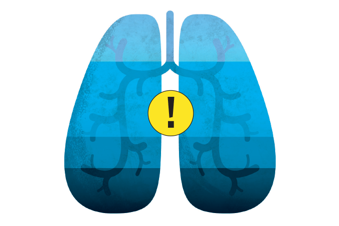 Desenho de pulmões azuis com ponte de exclamação no meio