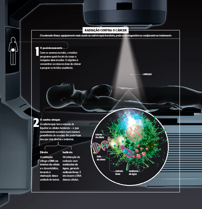 Infográfico mostrando como a radioterapia funciona