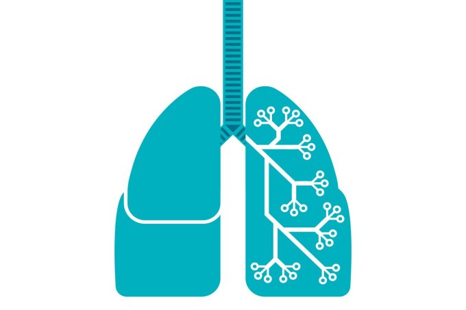 Tomografia para câncer de pulmão
