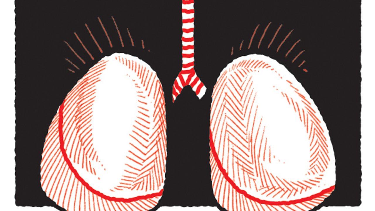 ilustração de pulmões inflamados
