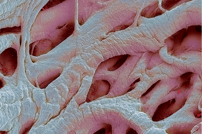 Imagem de microscopia eletrônica exibe estrutura interna do coração.