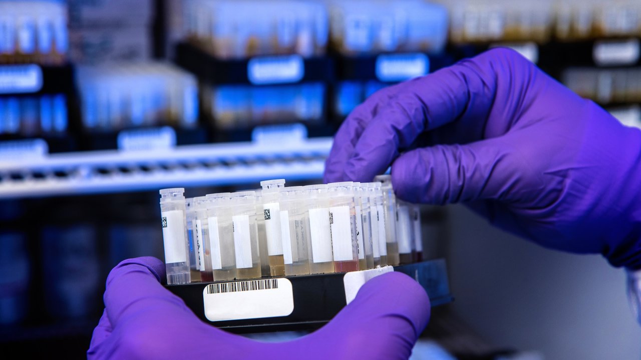 amostras em laboratório para testes de anticorpos
