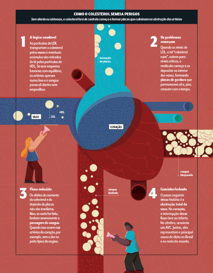 infográfico mostrando como colesterol entope as artérias