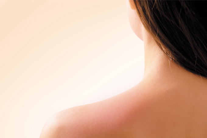 foto de pele inflamada nas costas de uma mulher