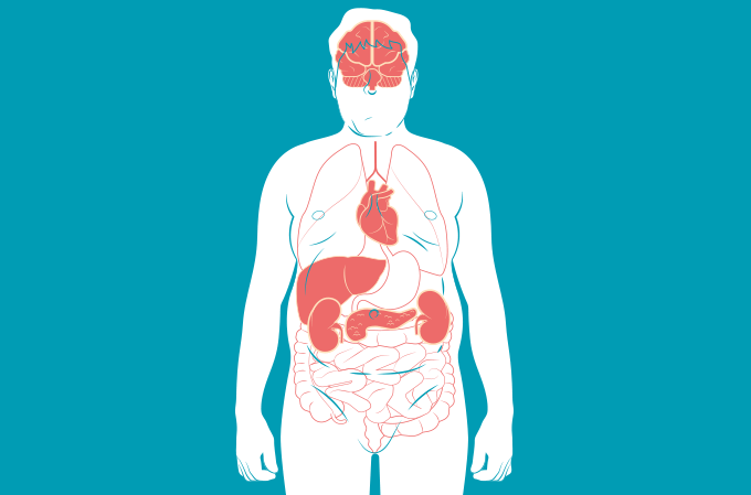 poate ca venele varicoase merg dupa natere medicina populara în varicoza