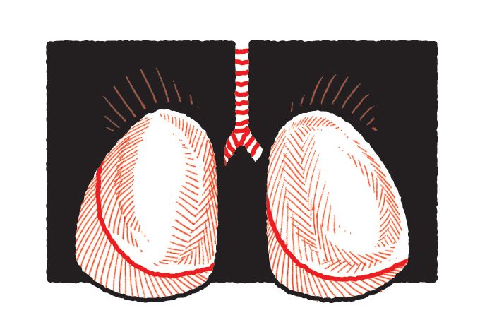 sintomas do câncer de pulmão e tratamento