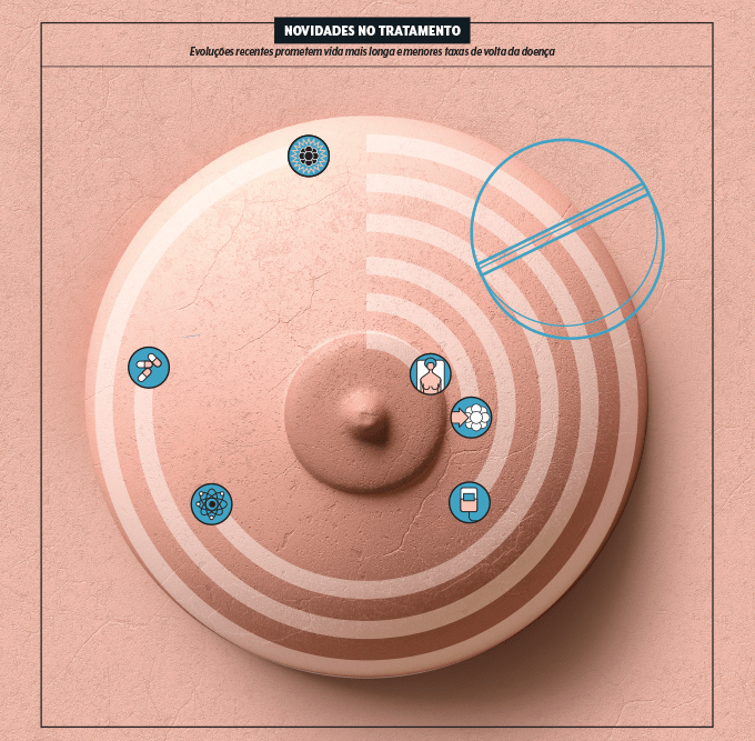novidades no tratamento do câncer de mama