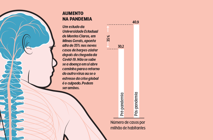 aumento de casos de herpes-zóster na pandemia