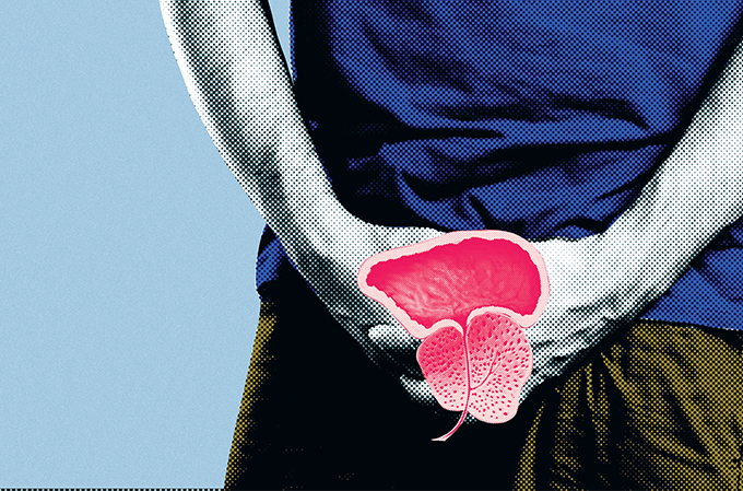 como se pode prevenir o câncer de próstata