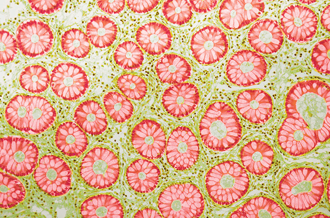 Zoom: gominhos no abdômen