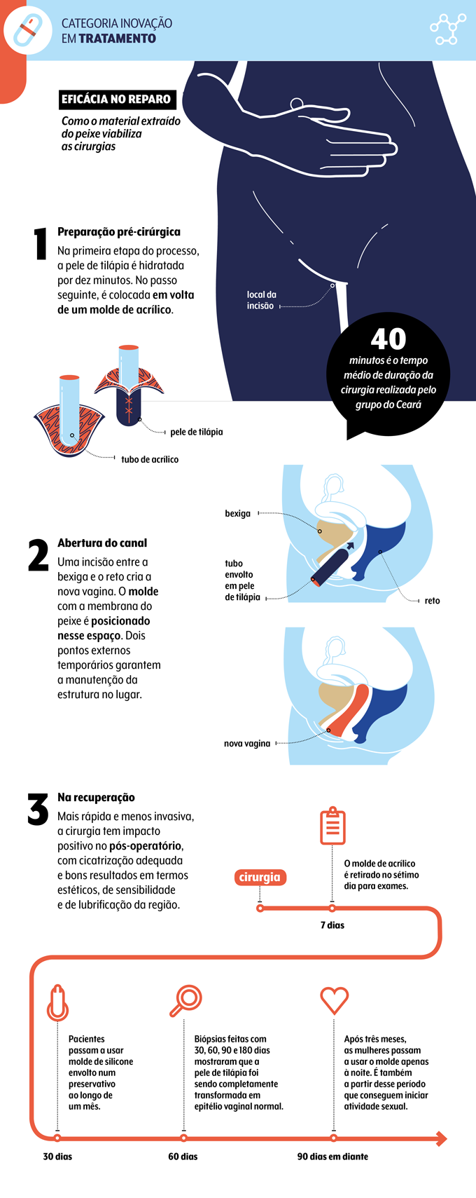 infográfico sobre trabalho da UFC que usa pele de tilápia na reconstrução vaginal