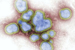 sintomas da nova gripe H3N2