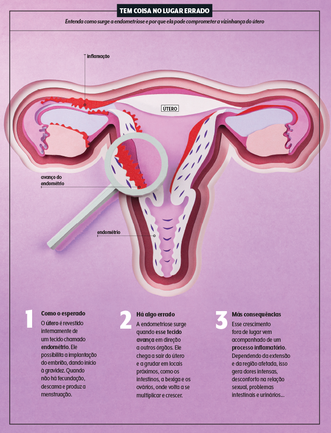 O que pode ser considerada uma menstruação normal? – Clínica Ayroza Ribeiro