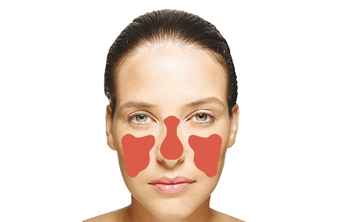 Retrato do lúpus no Brasil