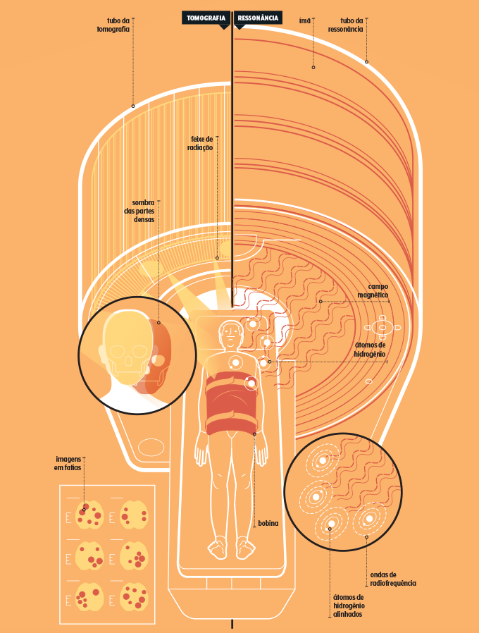 como funciona ressonância magnética