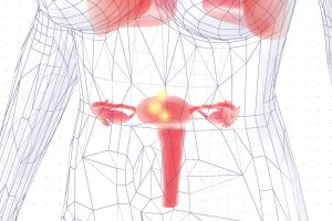 o que é endometriose e seus sintomas